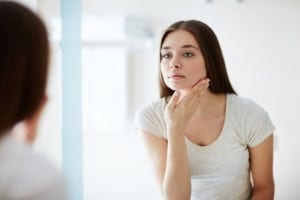 acne treatment vancouver, what causes acne