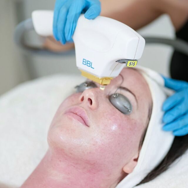 Skin Care and Laser Clinic Vancouver